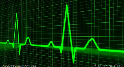 ECG verde