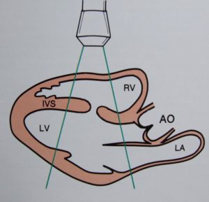 ecocardiogramma-color-doppler-via-cassia-la-storta