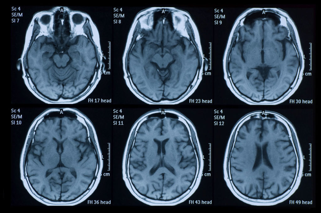 neurologia-neurologo-cassia-la-storta