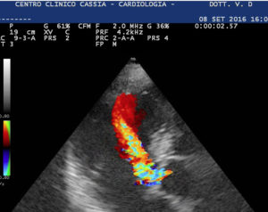 Cardiologia-via-Cassia-La-Storta