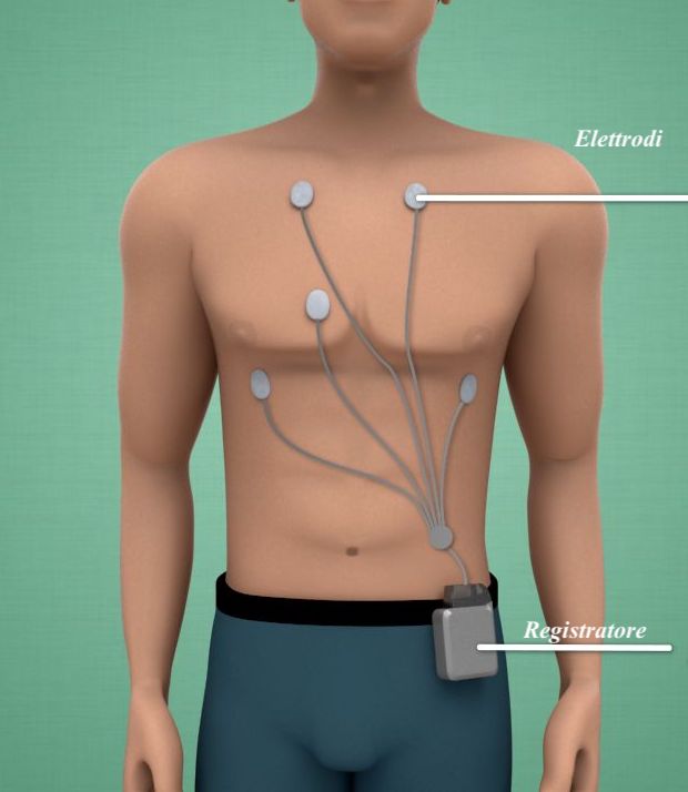 ECG-holter-24-48-ore-via-cassia-la-storta