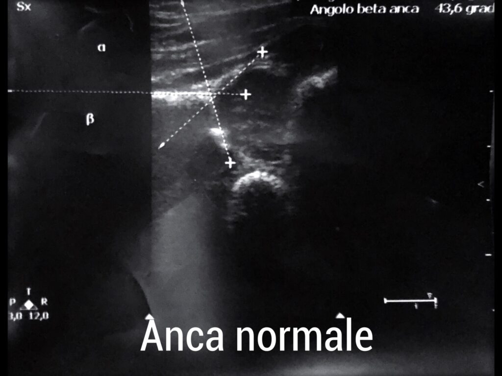 ecografia-via-cassia-la-storta-1713